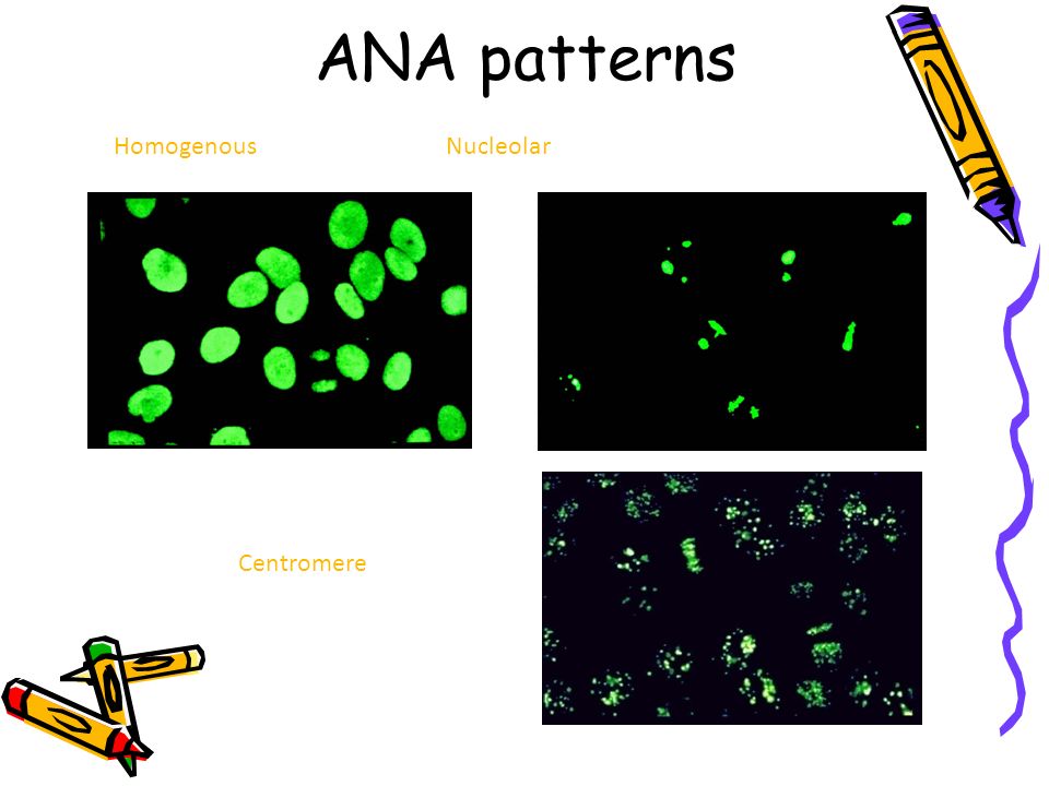 ANA patterns Homogenous Nucleolar Centromere
