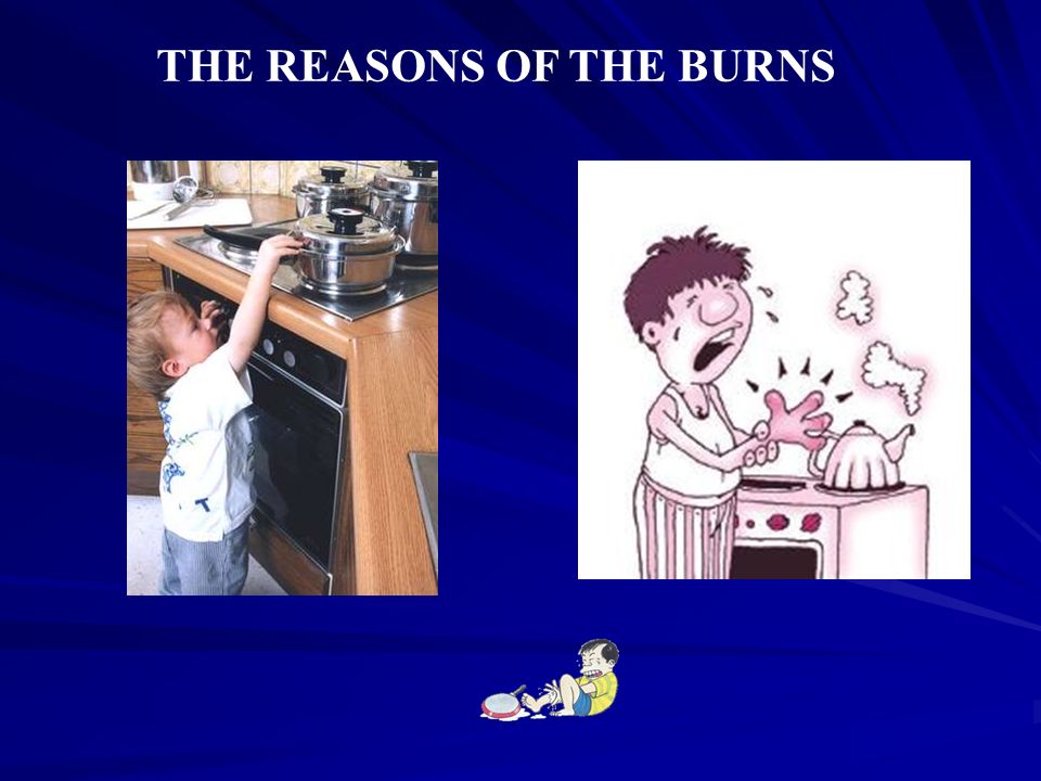 THERMAL TRAUMA ( BURNS, ELECTRICAL TRAUMA, FROST BITE (FREEZING) ) - ppt  download