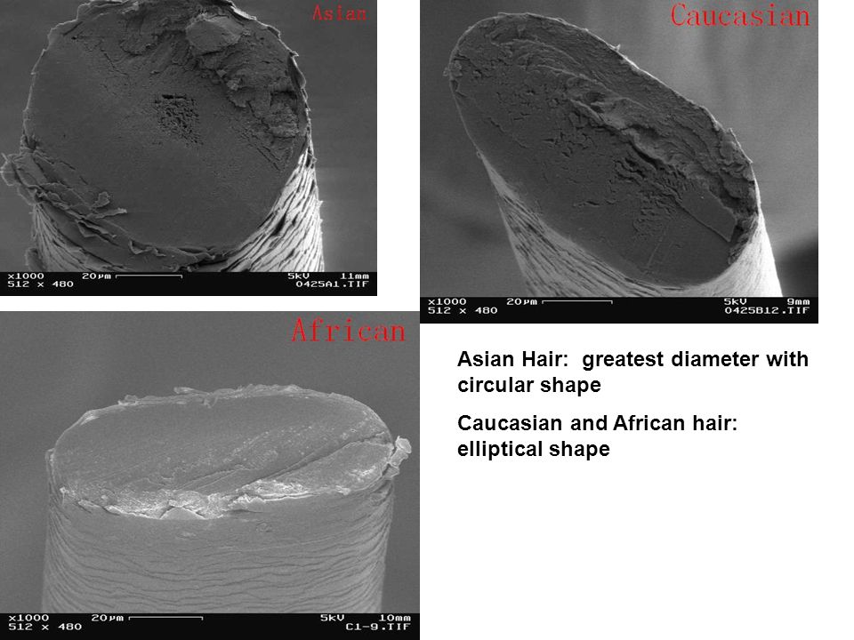 Asian Hair: greatest diameter with circular shape Caucasian and African hair:  elliptical shape. - ppt download