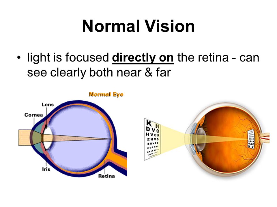Near and far Vision. Far sightedness and near sightedness. Near & far. Clear both.