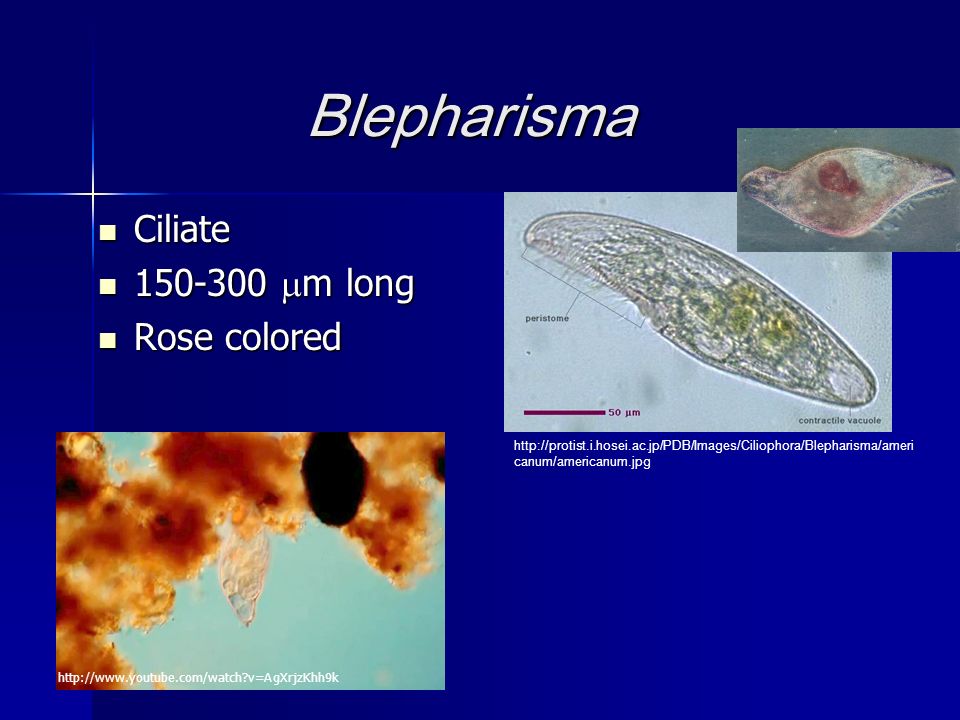 Blepharisma   canum/americanum.jpg Ciliate Ciliate  m long  m long Rose colored Rose colored   v=AgXrjzKhh9k