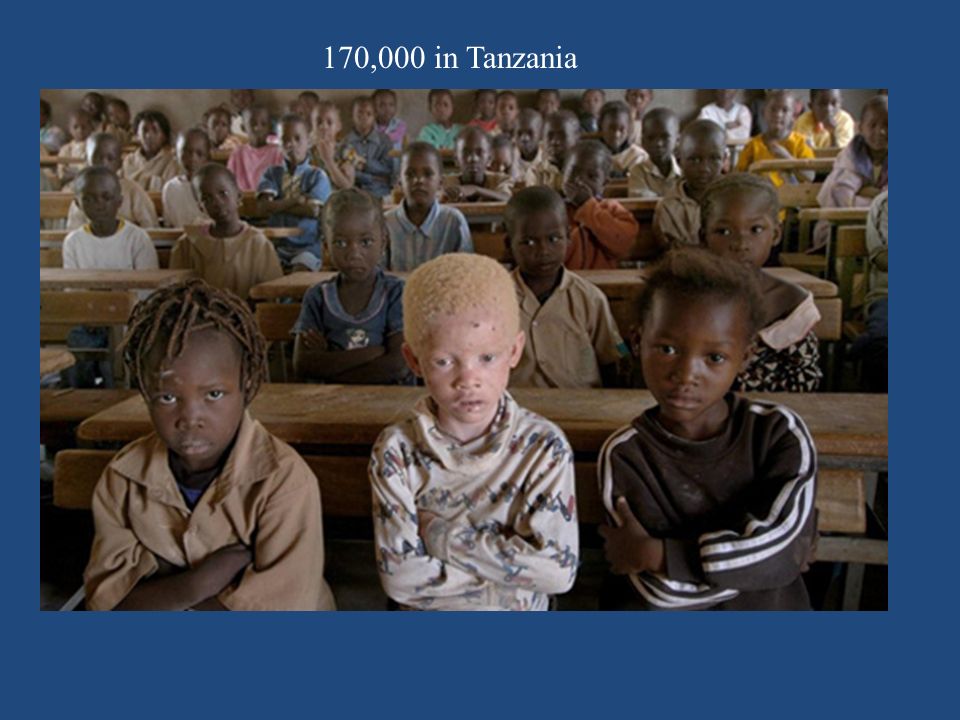 170,000 in Tanzania