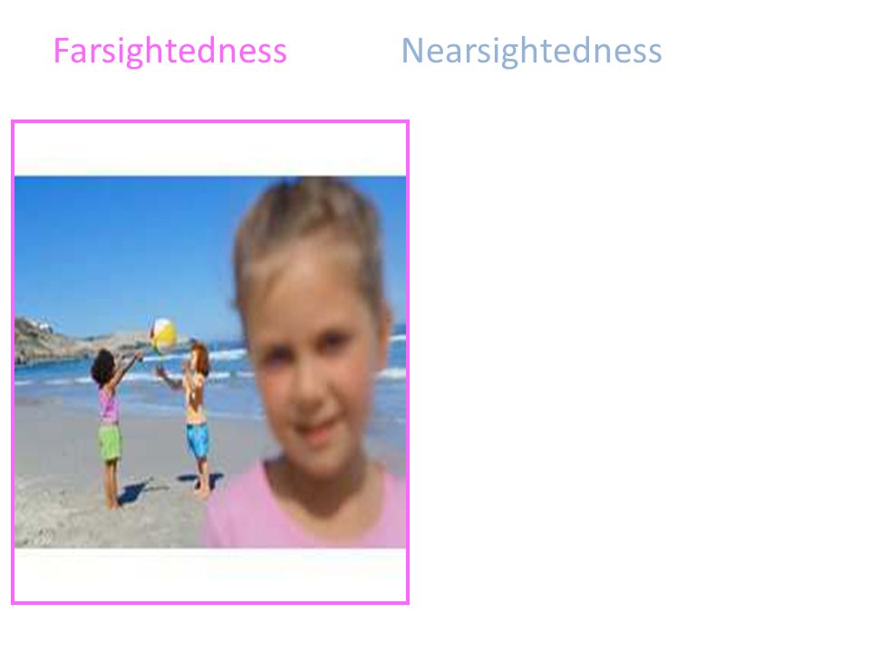 FarsightednessNearsightedness
