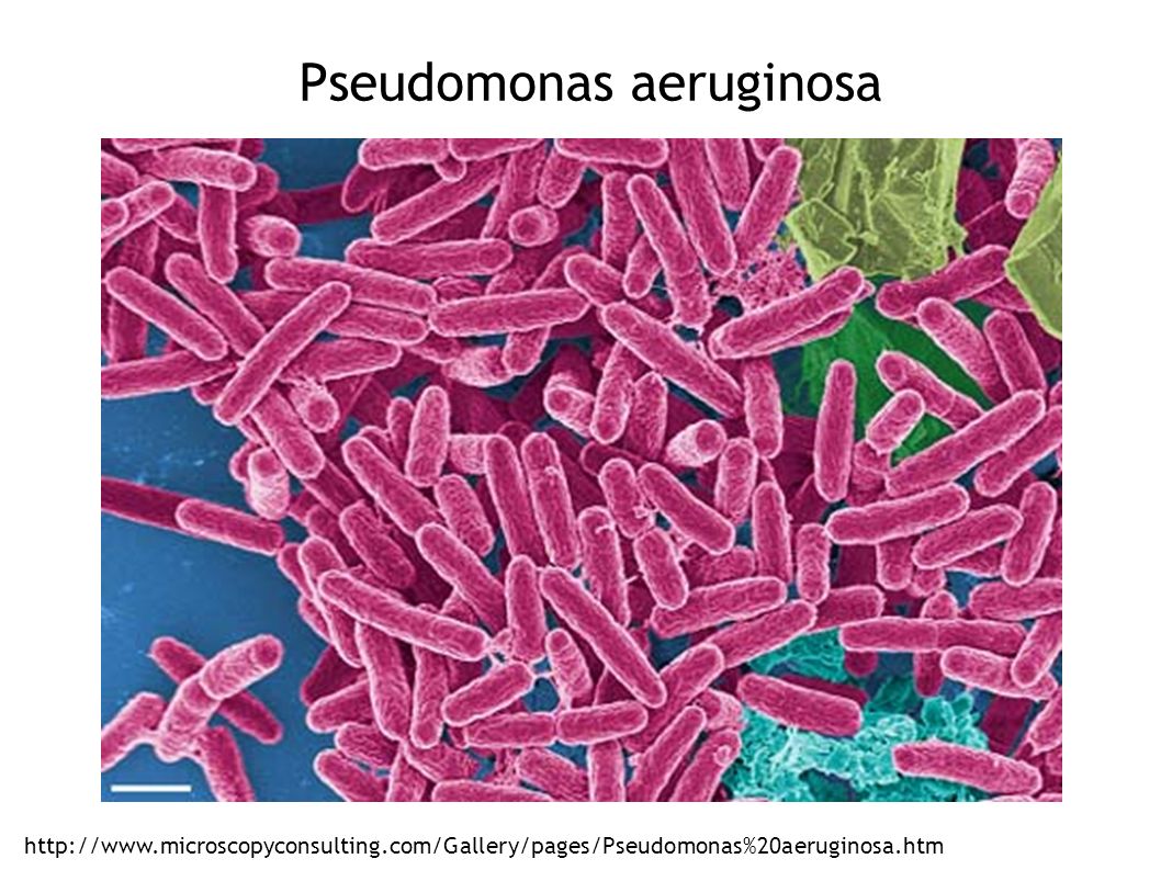 Бактерии в основе. Микроорганизмы рода Pseudomonas. Pseudomonas aeruginosa микроскоп. Pseudomonas Fluorescens препараты. Pseudomonas aeruginosa по Граму.