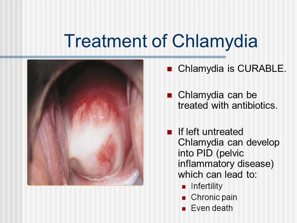sexually transmitted diseases chlamydia chlamydia trachomatis is antibiotics for chlamydia