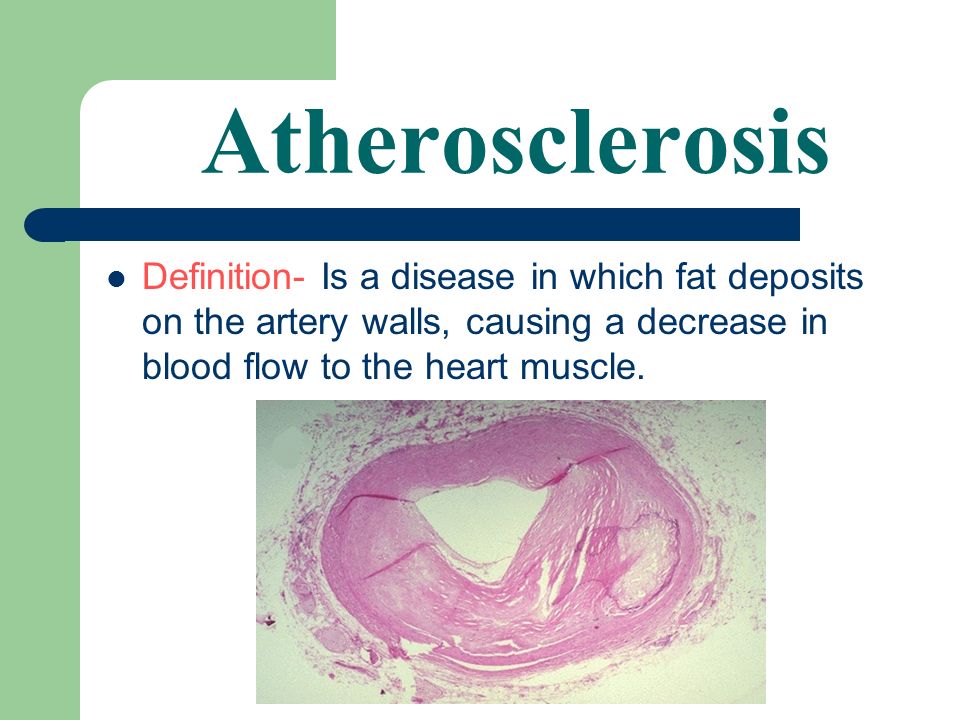 Definition- is a general term used to describe several conditions that cause hardening and thickening of the arteries.