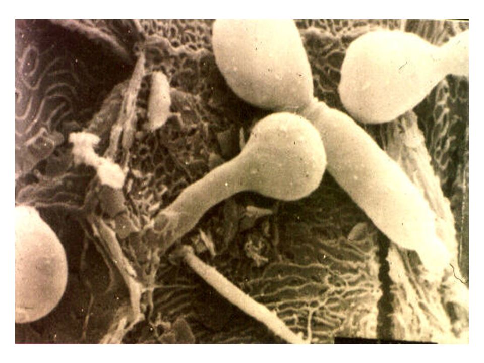 Молочница гриб. Грибы кандида под микроскопом. Грибковые инфекции человека.