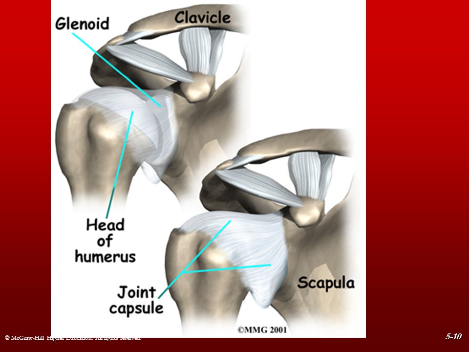 Капсула плечевого сустава. Вывих плечевого сустава анатомия. Гленоид плечевого сустава анатомия. Адгезивный капсулит тазобедренного сустава. Повреждение гленоида плечевого.