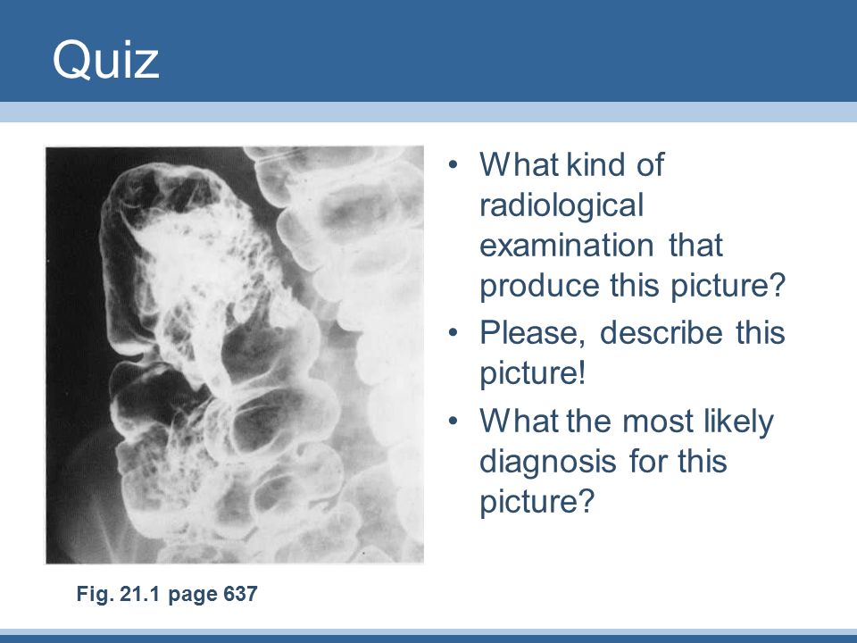 Quiz What kind of radiological examination that produce this picture.