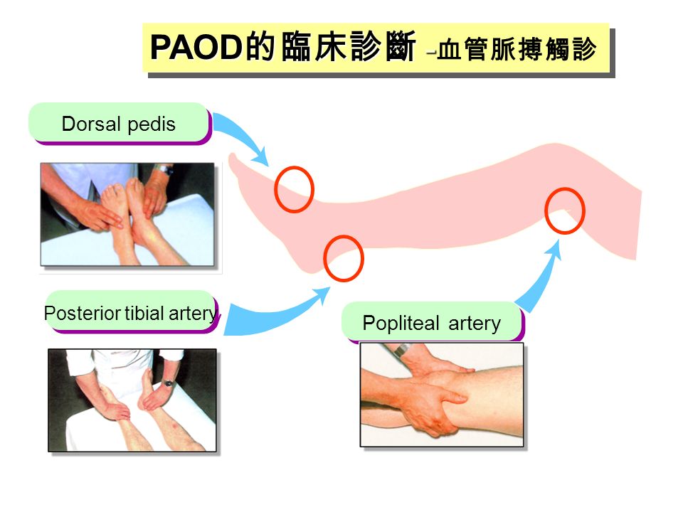 Diagnosis And Treatment Of Peripheral Arterial Disease 高雄長庚醫院心臟內科 傅懋洋教授 Ppt Download