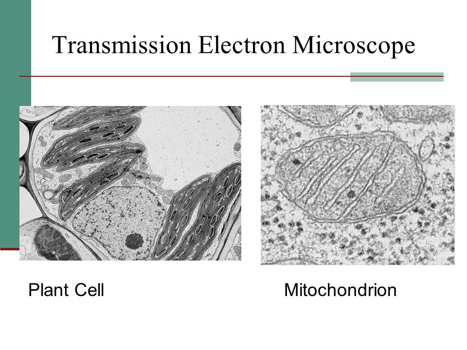 Transmission Electron Microscope Plant CellMitochondrion