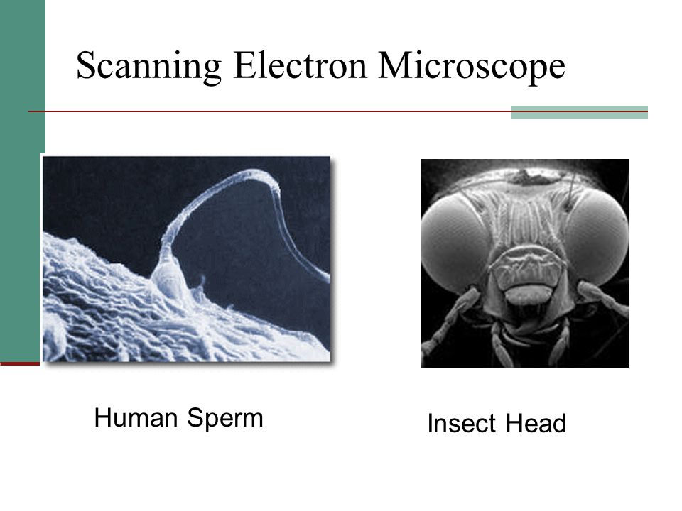 Scanning Electron Microscope Human Sperm Insect Head