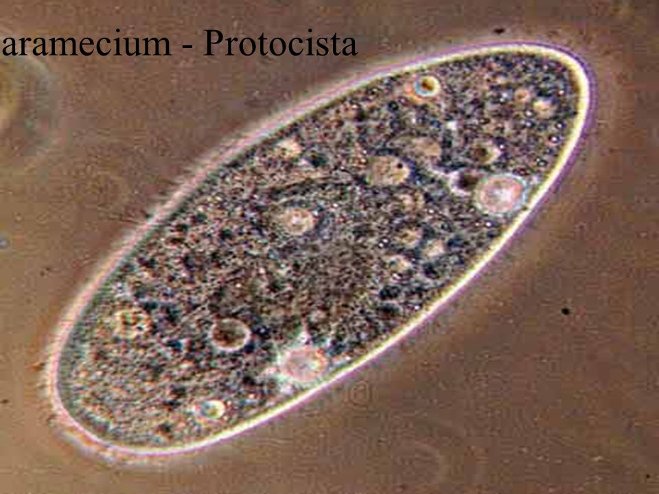 Paramecium - Protocista