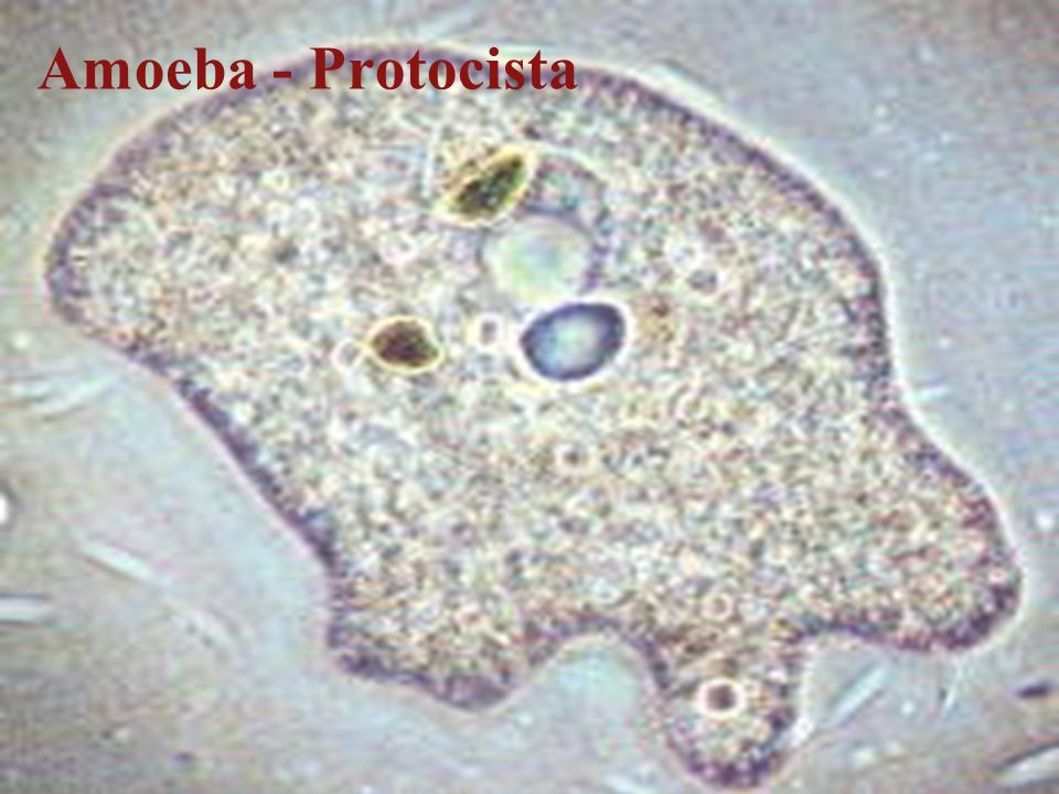 Amoeba - Protocista