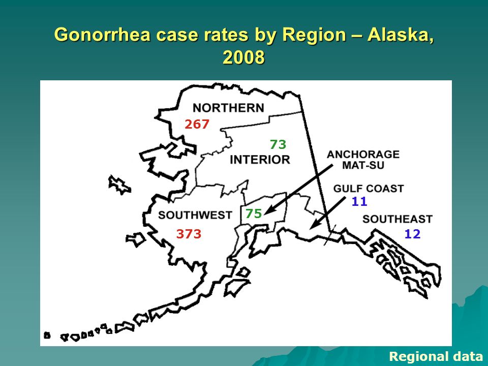 Gonorrhea case rates by Region – Alaska, Regional data
