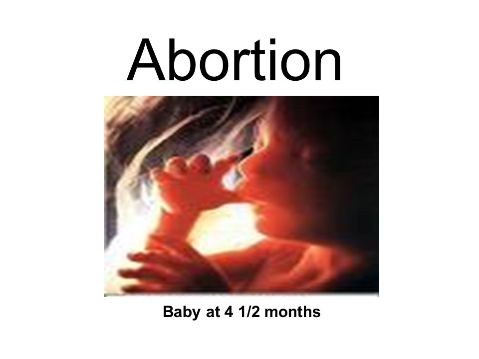 Image result for abortion at 2 months pictures