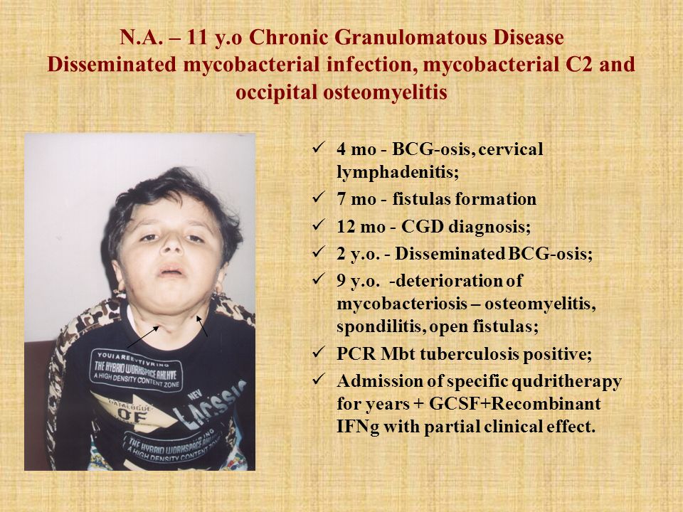 DIFFERENT THERAPEUTIC APPROACHES IN PATIENTS WITH CHRONIC GRANULOMATOUS ...