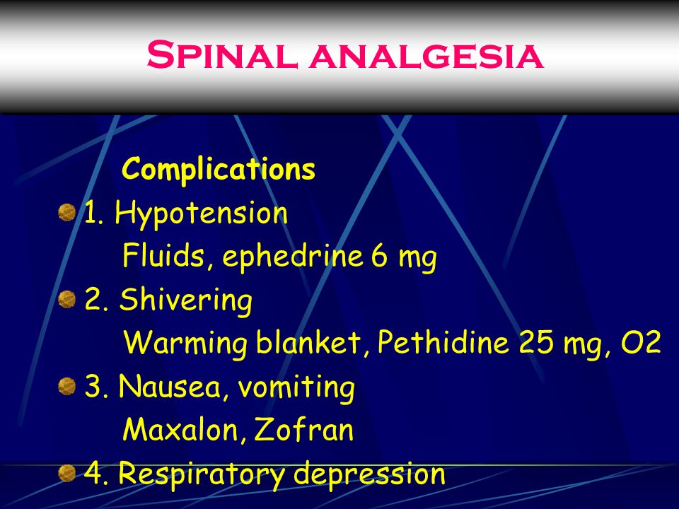 Spinal analgesia Complications 1. Hypotension Fluids, ephedrine 6 mg 2.