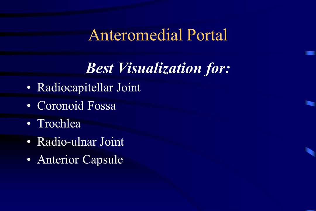 Anteromedial Portal Best Visualization for: Radiocapitellar Joint Coronoid Fossa Trochlea Radio-ulnar Joint Anterior Capsule