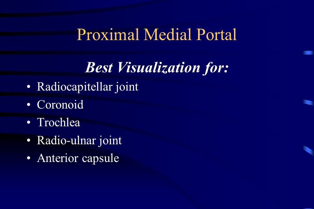 Best Visualization for: Radiocapitellar joint Coronoid Trochlea Radio-ulnar joint Anterior capsule