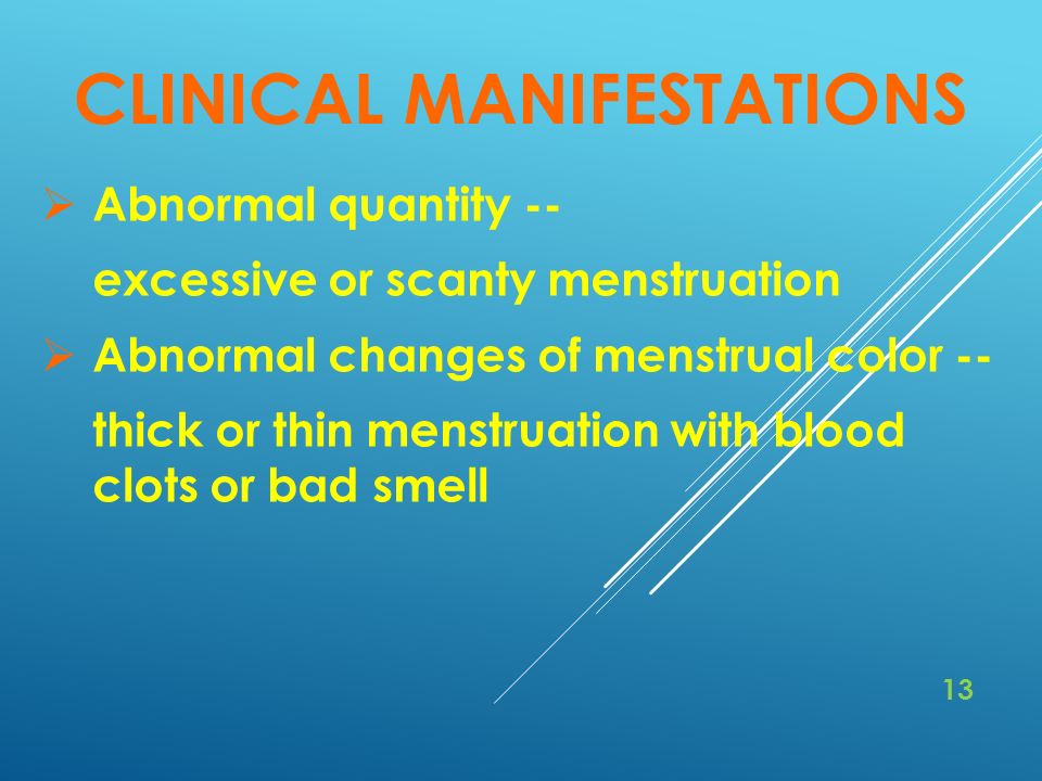 Bad smell before menstruation