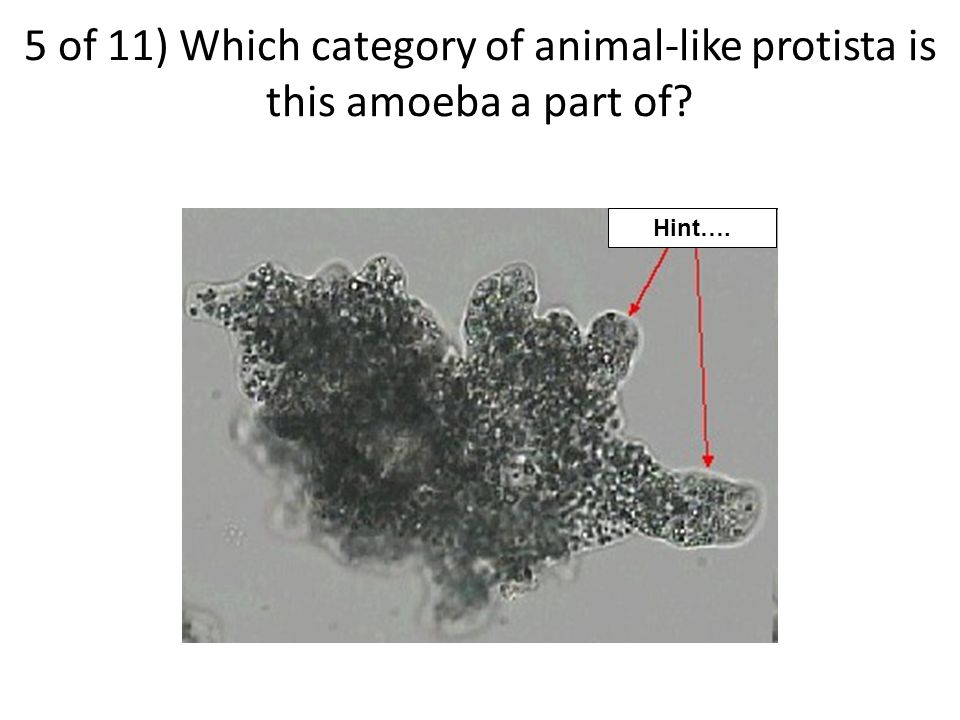 4 of 11) What is the ONE main (most important) difference between bacteria and protista