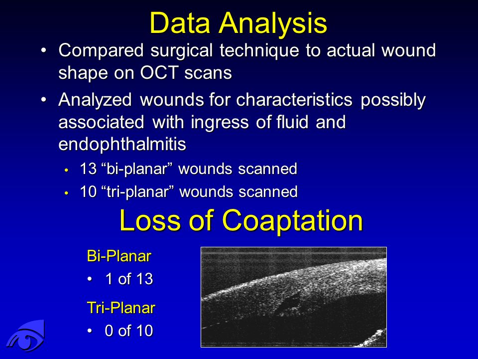 Data Analysis Compared surgical technique to actual wound shape on OCT scansCompared surgical technique to actual wound shape on OCT scans Analyzed wounds for characteristics possibly associated with ingress of fluid and endophthalmitisAnalyzed wounds for characteristics possibly associated with ingress of fluid and endophthalmitis 13 bi-planar wounds scanned 13 bi-planar wounds scanned 10 tri-planar wounds scanned 10 tri-planar wounds scanned Loss of Coaptation Bi-Planar 1 of 131 of 13 Tri-Planar 0 of 100 of 10