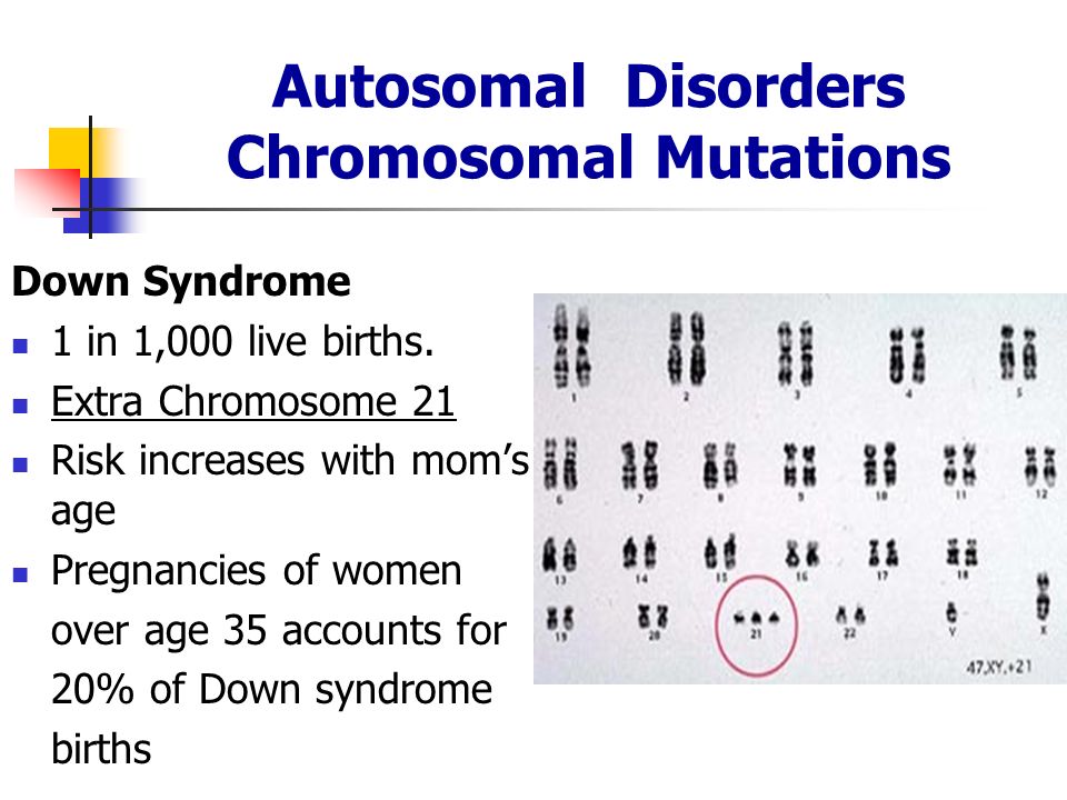Is Down Syndrome Autosomal Or Sexlinked