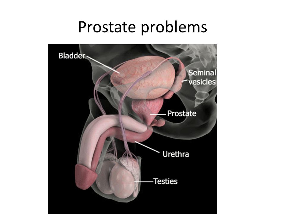 Ts Prostate