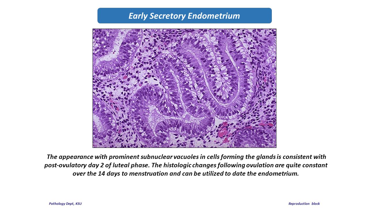 Histology secretory endometrium dyssynchronous endometrium