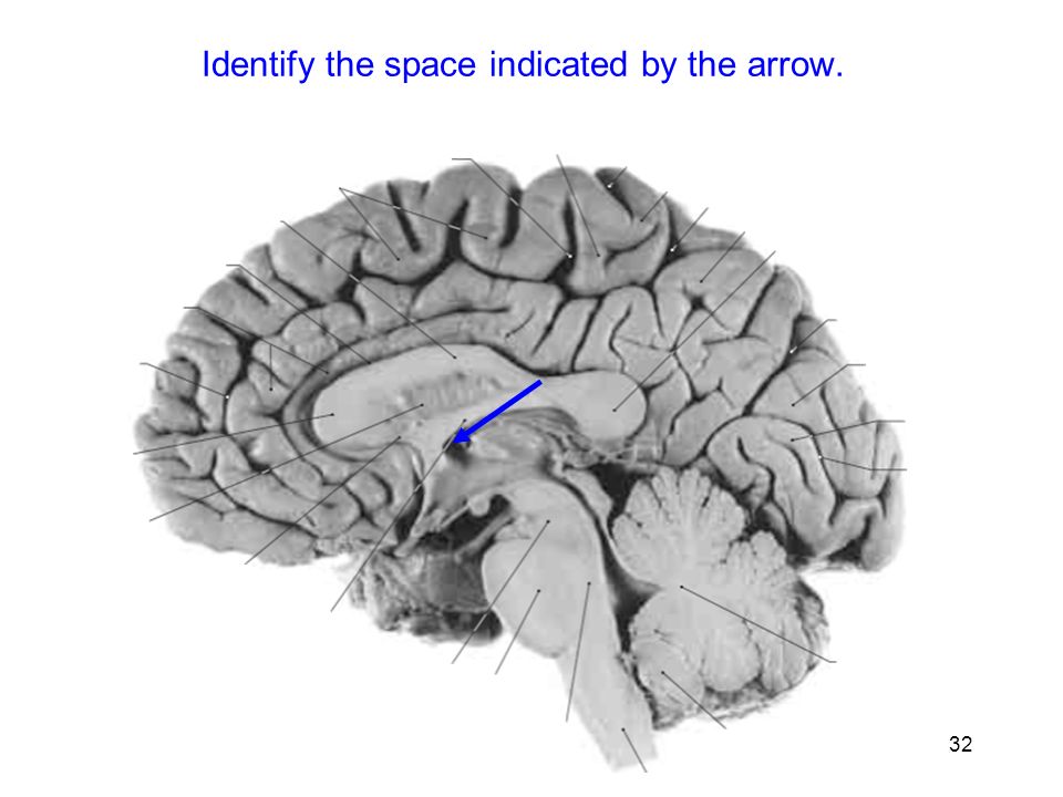 32 Identify the space indicated by the arrow.