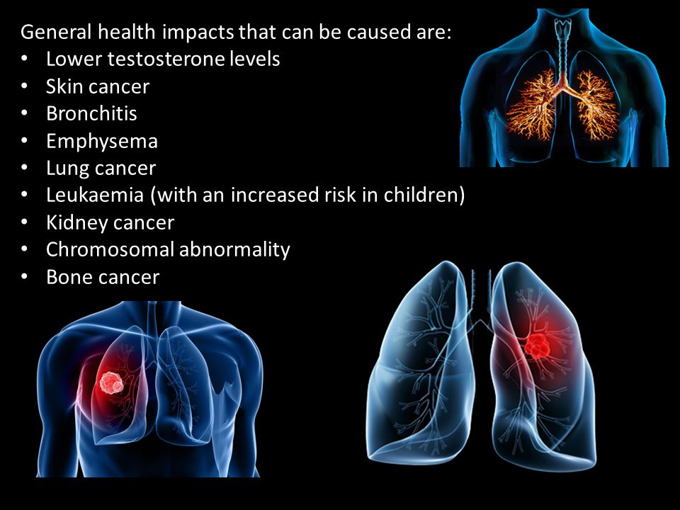 Environmental And Health Impacts Of Uranium Mining Ppt Download
