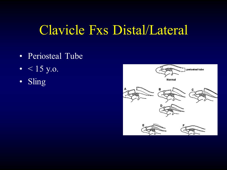 Pediatric Shoulder Injuries Joel Gonzales, M. D. Tuckahoe Orthopaedic ...