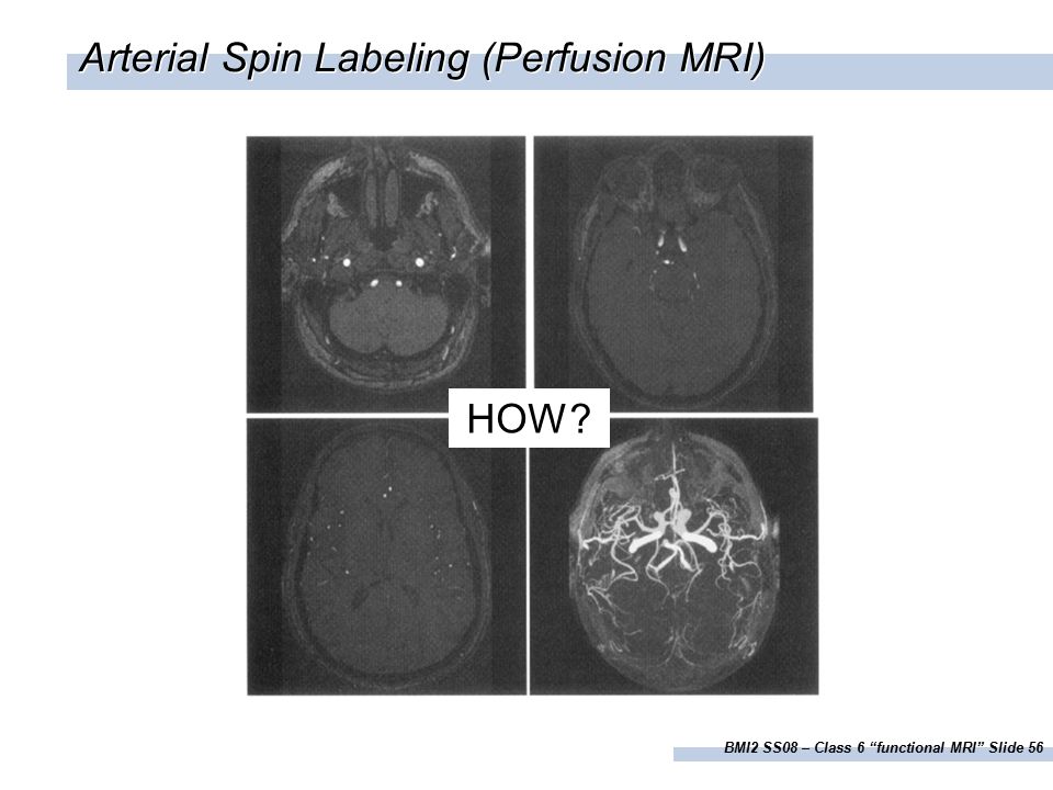 BMI2 SS08 – Class 6 functional MRI Slide 56 Arterial Spin Labeling (Perfusion MRI) HOW