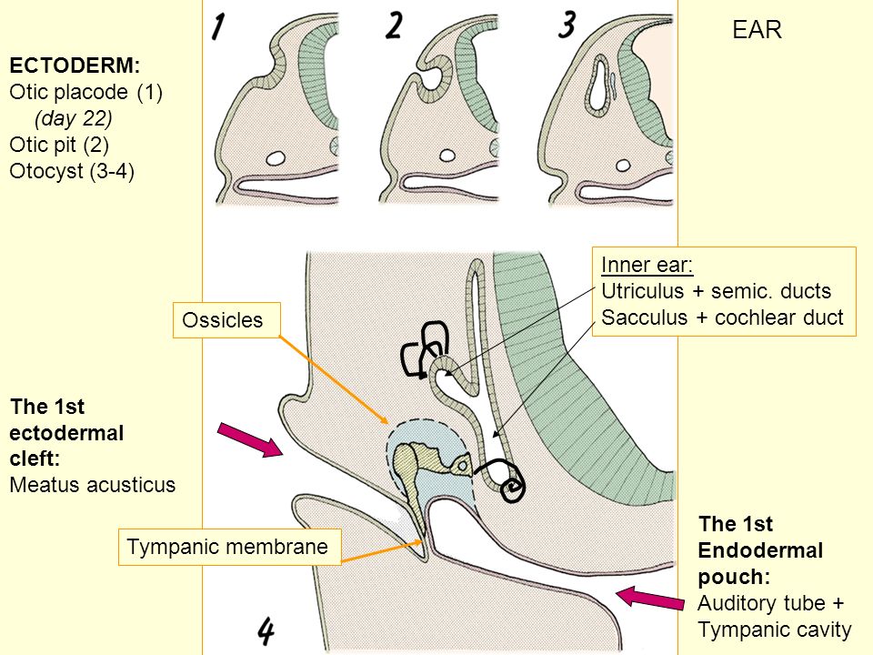 17 EAR ECTODERM: Otic placode (1) (day 22) Otic pit (2) Otocyst (3-4) The 1st ectodermal cleft: Meatus acusticus The 1st Endodermal pouch: Auditory tube + Tympanic cavity Inner ear: Utriculus + semic.