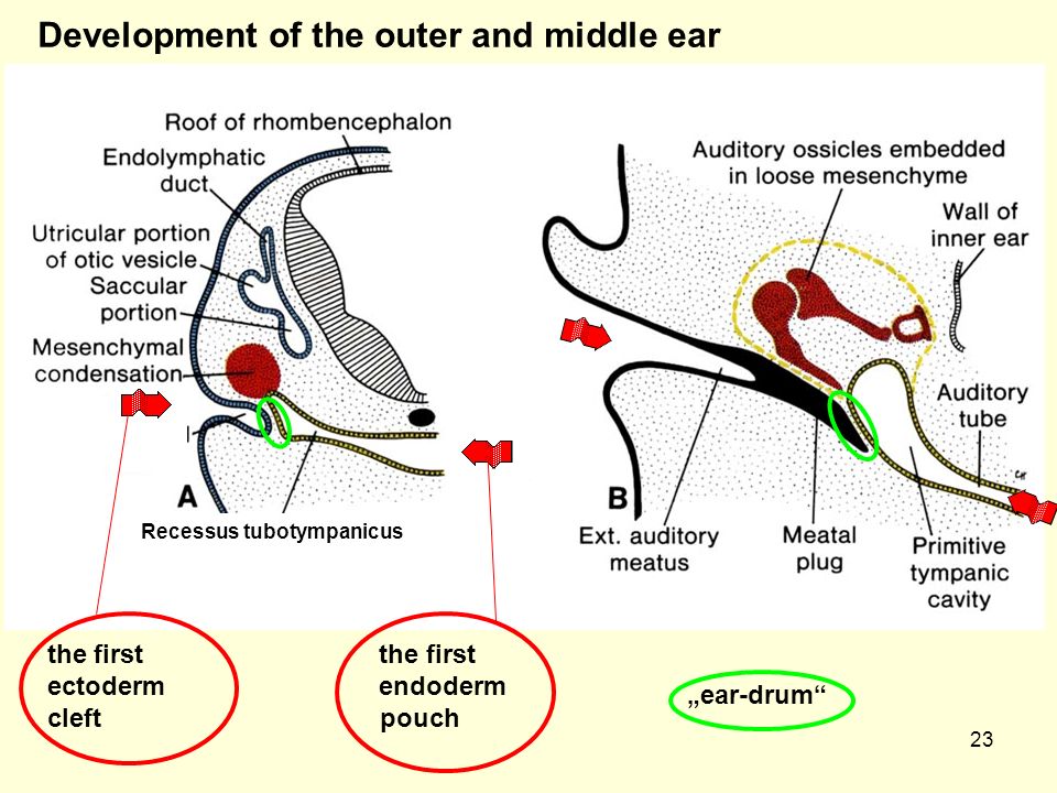 23 Development of the outer and middle ear the first the first ectoderm endoderm cleft pouch Recessus tubotympanicus „ear-drum