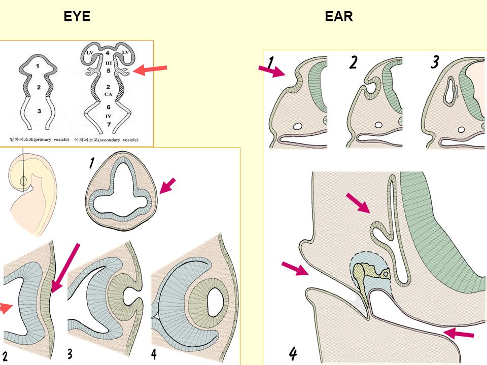 3 EYE EAR