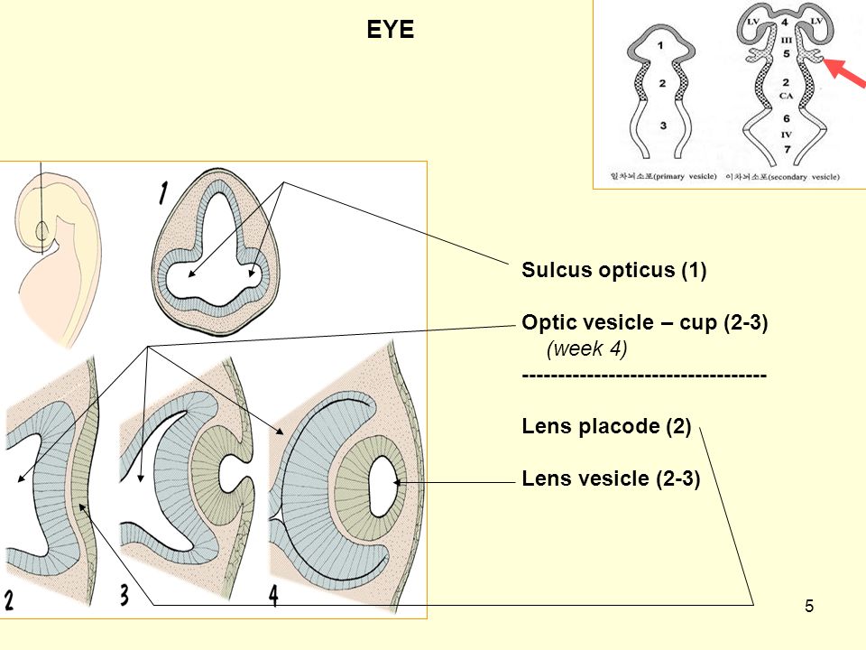 5 EYE Sulcus opticus (1) Optic vesicle – cup (2-3) (week 4) Lens placode (2) Lens vesicle (2-3)