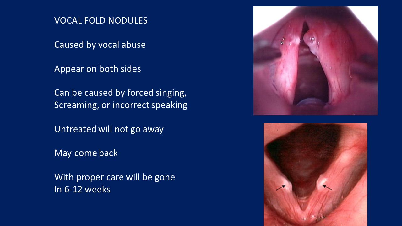 TYPES OF VOCAL DAMAGE. When the vocal folds are at rest, they are open  Healthy vocal folds & Laryngitis Like other tissues of the body, vocal  tissues. - ppt download
