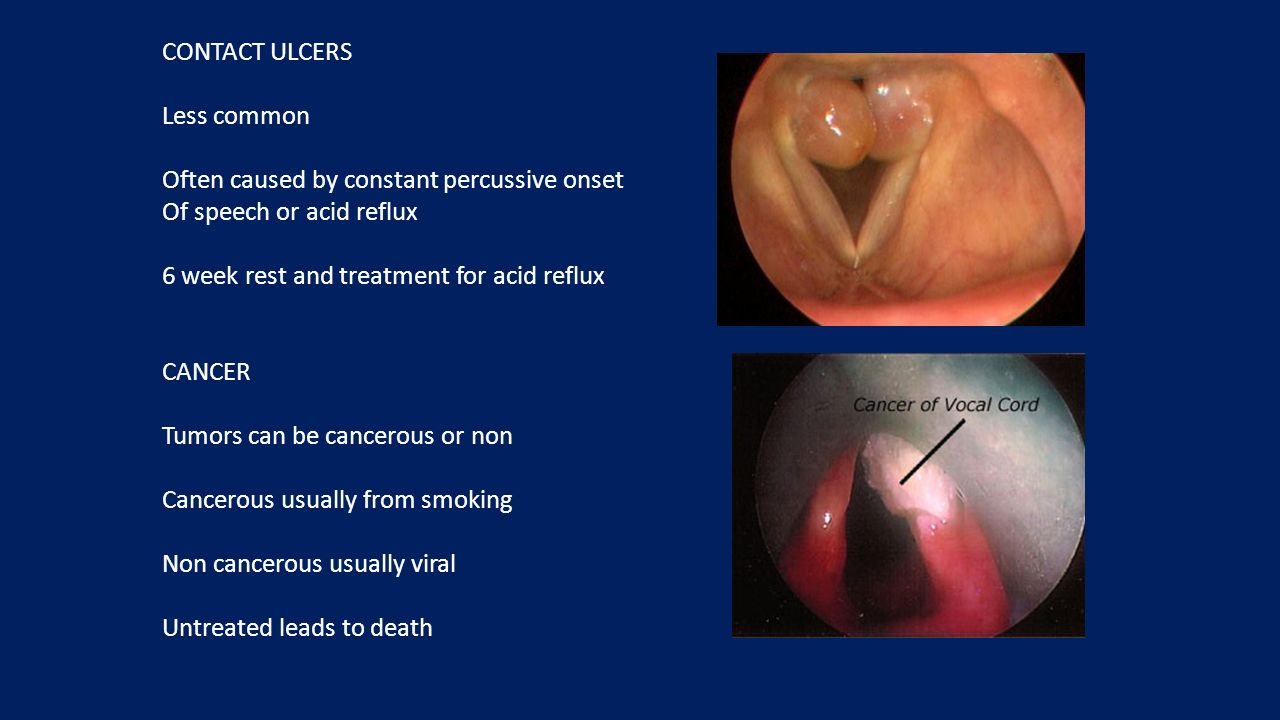 TYPES OF VOCAL DAMAGE. When the vocal folds are at rest, they are open  Healthy vocal folds & Laryngitis Like other tissues of the body, vocal  tissues. - ppt download