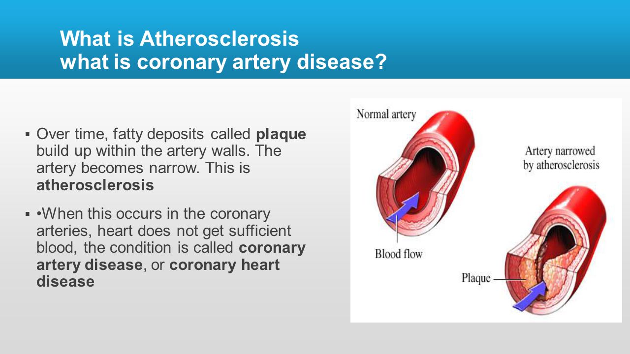 What is atherosclerosis 62 What is atherosclerosis 54