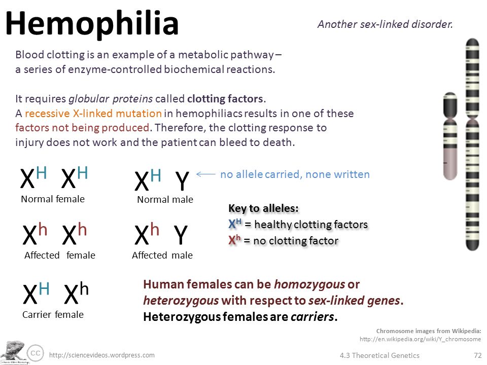 Hemophilia is a sex linked gene