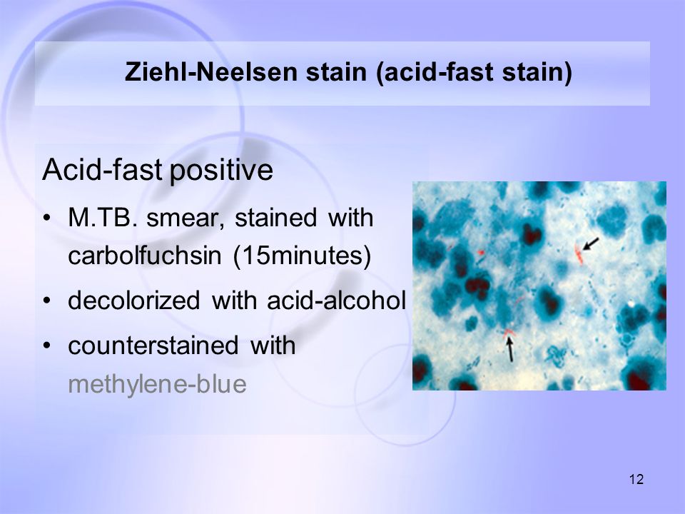 12 Ziehl-Neelsen stain (acid-fast stain) Acid-fast positive M.TB.