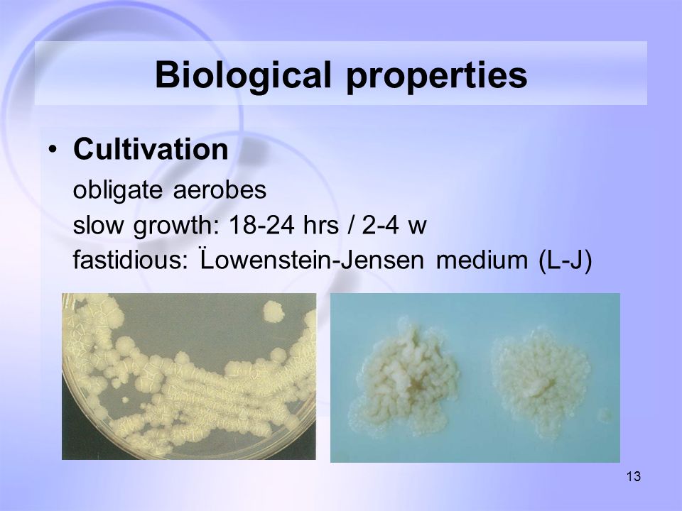 13 Biological properties Cultivation obligate aerobes slow growth: hrs / 2-4 w fastidious: Lowenstein-Jensen medium (L-J)..