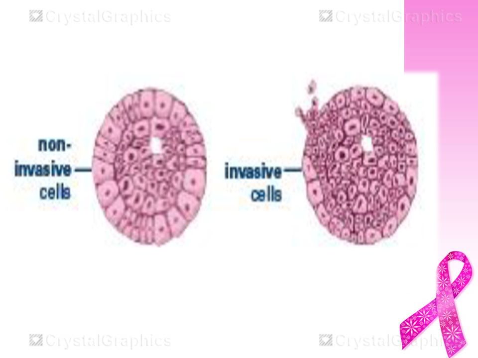 breast cancer biopsy types Gay rhodes rhodos