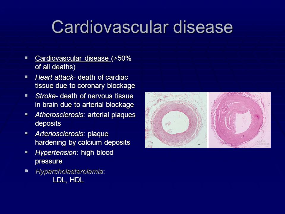 Cardiovascular disease  Cardiovascular disease (>50% of all deaths)  Heart attack- death of cardiac tissue due to coronary blockage  Stroke- death of nervous tissue in brain due to arterial blockage  Atherosclerosis: arterial plaques deposits  Arteriosclerosis: plaque hardening by calcium deposits  Hypertension: high blood pressure  Hypercholesterolemia: LDL, HDL