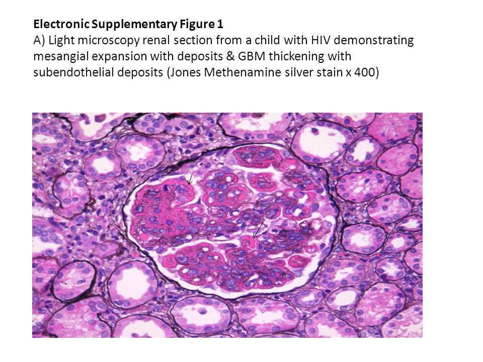 electronic supplementary figure 1