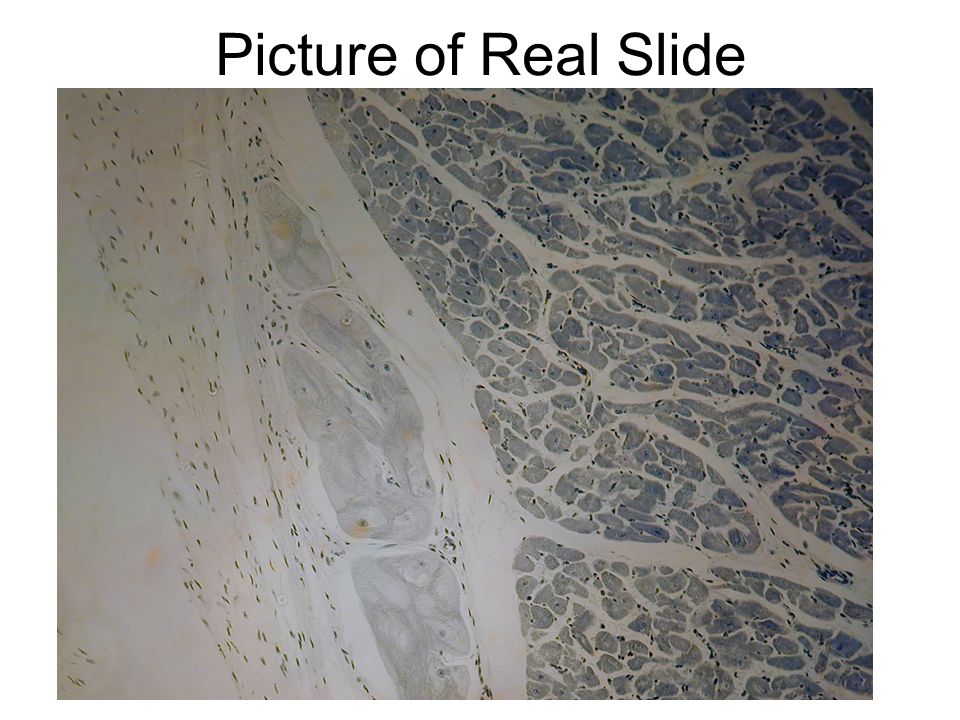 Picture of Real Slide