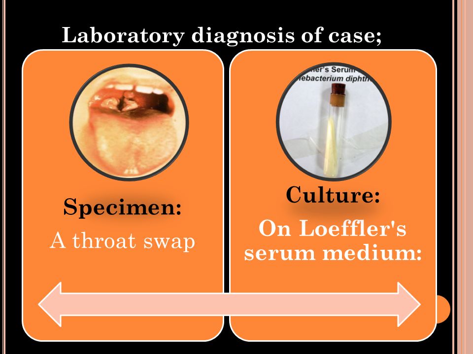 Laboratory diagnosis of case;