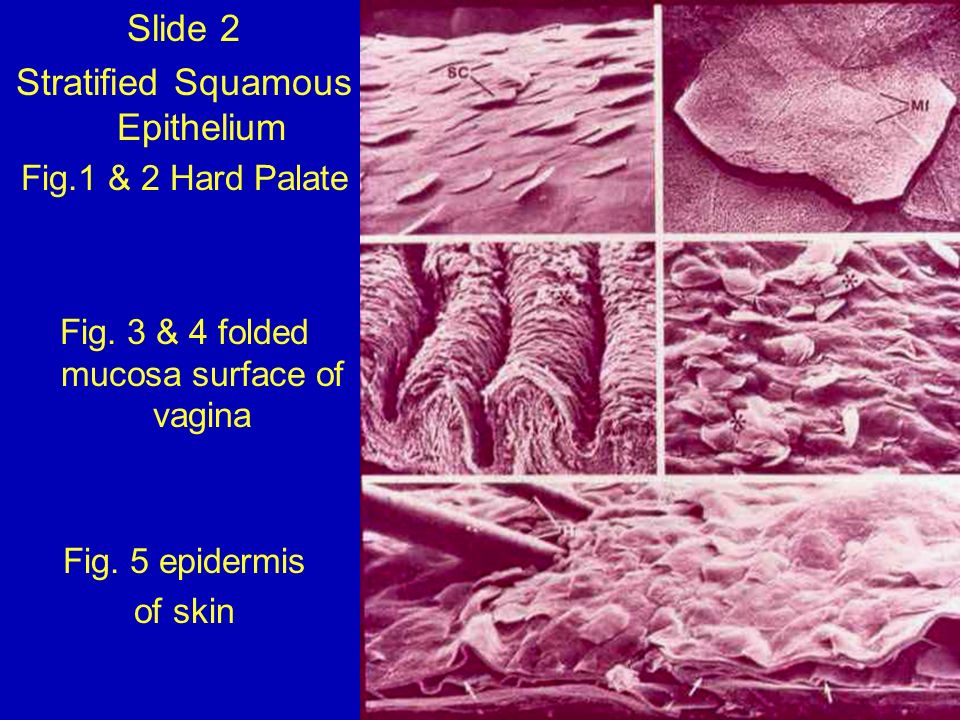 fold of mucos membrane in vagina Nude tan girls with fake boobs